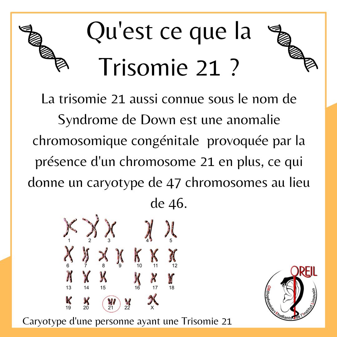 OREILortho's tweet photo. Voici une infographie pour la journée mondiale de la Trisomie 21 !
Afin de célébrer la différence, on porte des chaussettes dépareillées ! Alors n'hésitez pas à nous partager vos chaussettes dépareillées en nous identifiant ! 🧦
Bonne journée ! 

Vos VP PCS, Ariane et Lucie 😘 https://t.co/4OsiPJ9Iqj