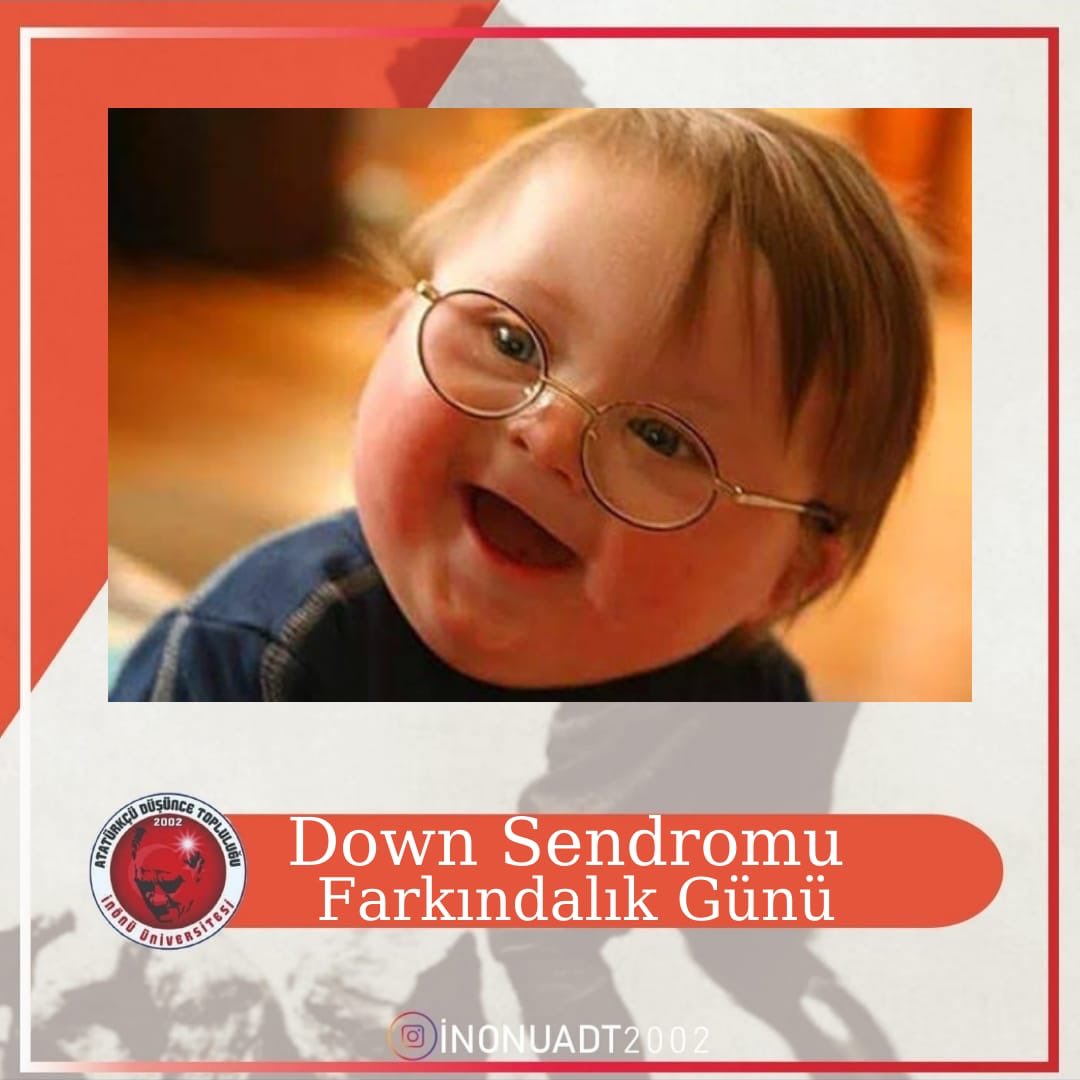Down Sendromlu çocukların insani değerleri yüksektir, yalan nedir bilmezler, yürekleri sevgi doludur ve sevgileri karşılıksızdır.
21 Mart Down Sendromu Farkındalık Günü kutlu olsun 
Tıpkı sizin gibiyiz +1 farkla