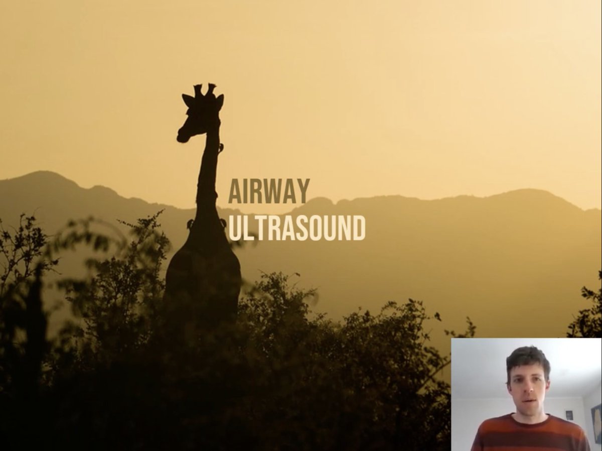 Peter Croft (@petereamonn) on Twitter photo Sneaky good 3 minute US primer on the 🔑 use of Airway Ultrasound (CTM + ETT identification)
@EuropSocEM <a href="/ACEP_EUS/">ACEP Ultrasound</a> <a href="/jiconnoly/">jimconnolly</a> @KasiaHamptonMD <a href="/mackendc/">David Mackenzie</a> <a href="/AndrewMFried/">Andrew Fried</a> <a href="/TomasVillen/">Tomas Villen</a> @VTEMSONO
Production credit: @rehberg_joshua (MMC US Fellow)
youtu.be/89-pwCg25GI via <a href="/YouTube/">YouTube</a> Sneaky good 3 minute US primer on the 🔑 use of Airway Ultrasound (CTM + ETT identification)
@EuropSocEM <a href="/ACEP_EUS/">ACEP Ultrasound</a> <a href="/jiconnoly/">jimconnolly</a> @KasiaHamptonMD <a href="/mackendc/">David Mackenzie</a> <a href="/AndrewMFried/">Andrew Fried</a> <a href="/TomasVillen/">Tomas Villen</a> @VTEMSONO
Production credit: @rehberg_joshua (MMC US Fellow)
youtu.be/89-pwCg25GI via <a href="/YouTube/">YouTube</a>