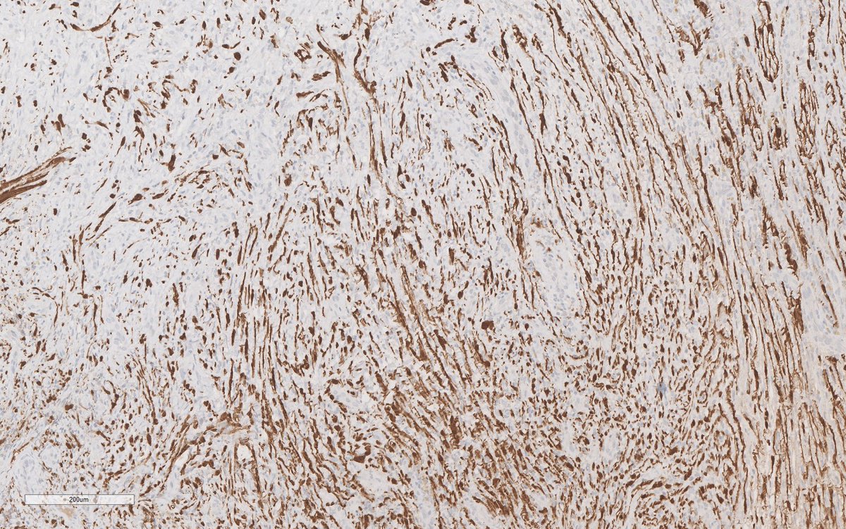 Ilan Weinreb 🇮🇱🇨🇦 אילן וינרב tweet media