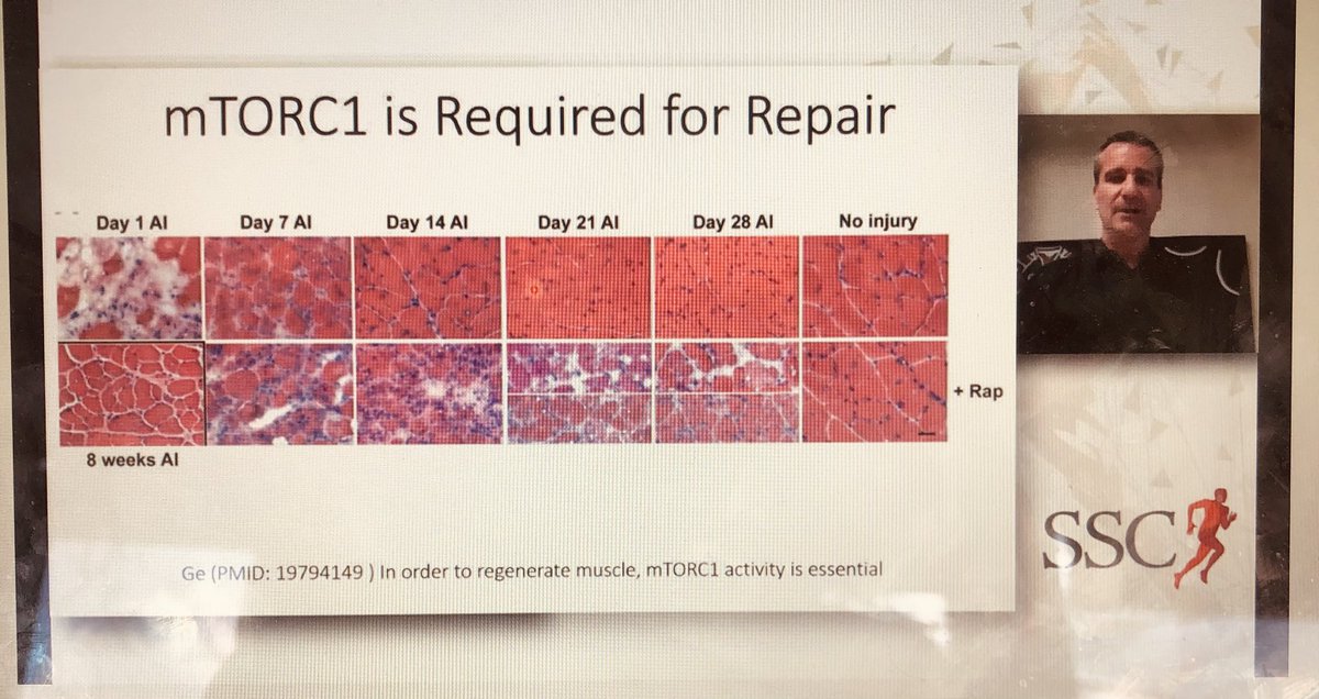 Great CPD last week <a href="/sscsportsmed/">SSC Sports Medicine</a> 

<a href="/MuscleScience/">Keith Baar</a> discussing loading &amp; nutrition to accelerate RTP. 

This image spoke volumes. 

Takeaways (1/2): 
1️⃣ Leucine rich protein (whey protein) and collagen supplementation can promote repair in both parts of the injured muscle cell