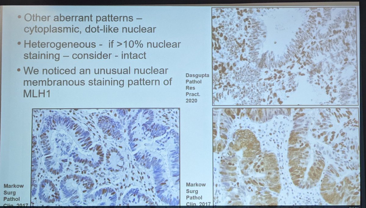 Dr David Jou's #Gynpath platform (from @BIDMCPath)               

Aberrant staining pattern in endometrial cancers w MMR ihc

#USCAP2022 #USCAP22
