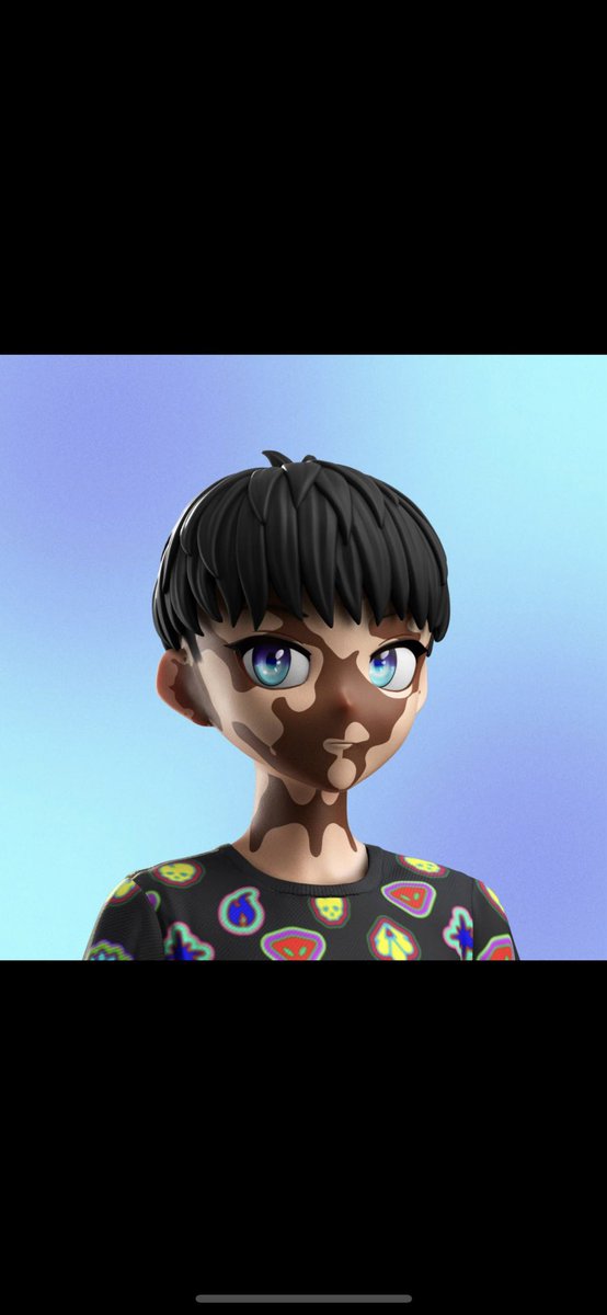 AlexBouchara's tweet photo. @Alts_Anonymous @RTFKTstudios @Gagosian @takashipom My Vitiligo 🅿️ https://t.co/RkGUnrld8D