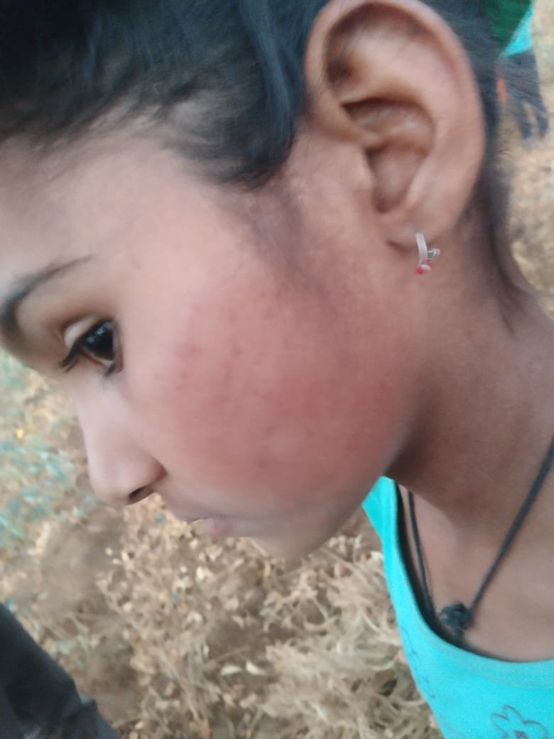 zeerajasthan_'s tweet photo. #Churu #बीदासर : राजकीय विद्यालय के हैवान शिक्षक ने की सारी हदें पार

तीसरी कक्षा की मासूम बच्ची के साथ कि बेरहमी से मारपीट, शिक्षक ने आठ वर्षीय मासूम को पीट पीटकर किया अचेत

#RajasthanNews https://t.co/w4jssehoAa