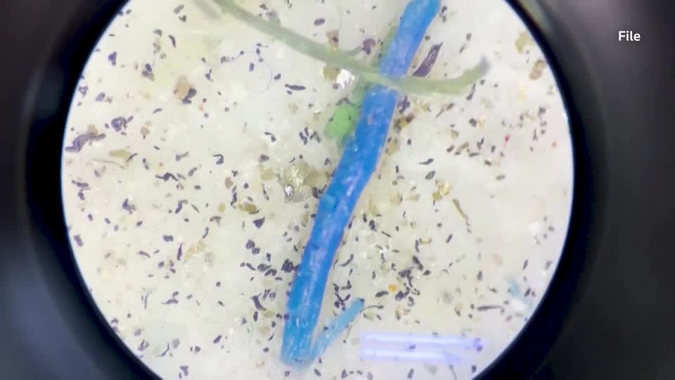 人間の血液からマイクロプラスチックが初めて発見される