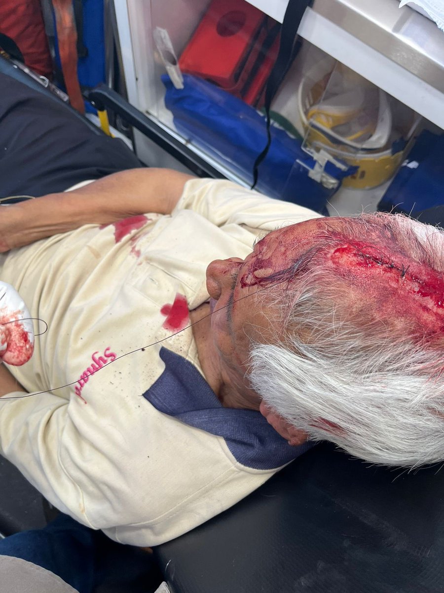 luiz__gerardo's tweet photo. Hoy, a medio día, mi abuelo se encontraba barriendo la acera de su trabajo (un taller a dos calles del mercado jamaica), un auto llegó a estacionarse afuera por lo que mi abuelo le pidió no dejar su auto.
El salvaje que conducía se bajó y prácticamente lo molió a golpes. https://t.co/HbvoLt0dCB