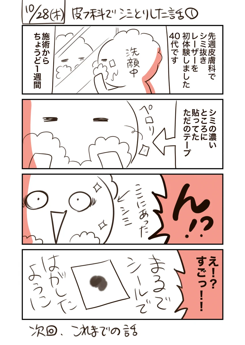 皮膚科でのシミとりレーザー体験談！痛そうだけどコスパはよさげ！