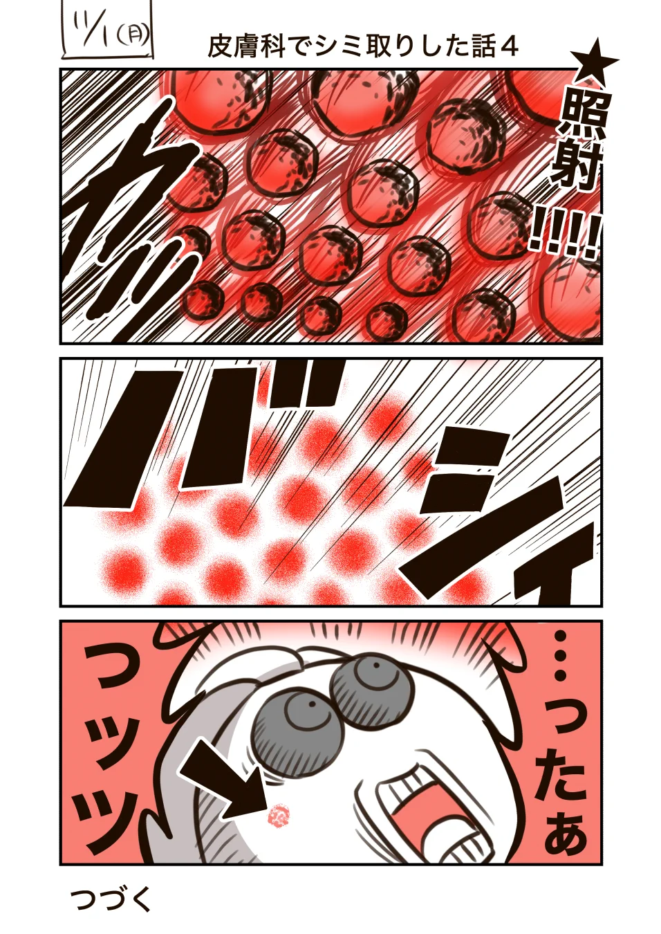 皮膚科でのシミとりレーザー体験談！痛そうだけどコスパはよさげ！