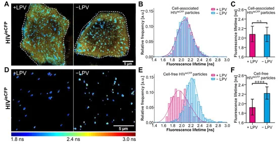 VirusesMDPI's tweet photo. #Proteolytic processing of Gag by the viral protease is essential for the structural rearrangements that mark the #transition from immature to mature, #infectious viruses.

Read more at https://t.co/fHK9DUkOme https://t.co/LuRlQrsid6