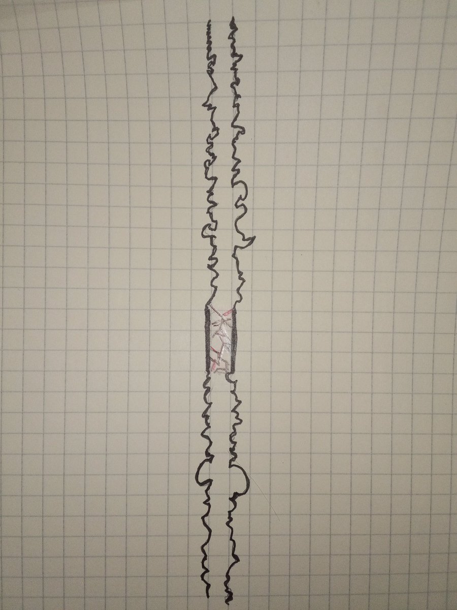 DnDBones's tweet photo. List of a few NPC names from my notes. Also, a low level tunnel trap. Muscle Snap Trap and Map coming tomorrow! #dungeonsanddragons #dnd #ttrpg #pathfinder2e #dnd5e #free #fantasy #dndmap #original #handdrawn #rpg #dndhelp #dndart #DnDcharacter https://t.co/otgaqBkka6