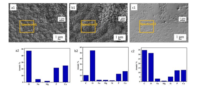 In vitro evaluation of degradation, cytocompatibility and antibacterial property of polycaprolactone/hydroxyapatite composite coating on bioresorbable magnesium #alloy sciencedirect.com/science/articl…