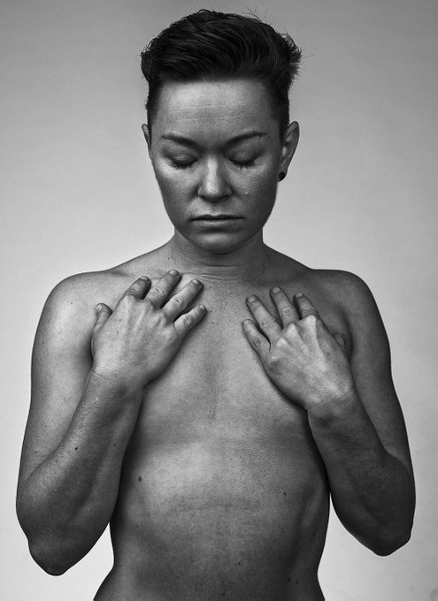 I'd told myself that I'd get top surgery by the time I turned 40. I held back, scared of going under<a href="/tag/iamnonbinary"class="tags"><span>#iamnonbinary</span></a>
