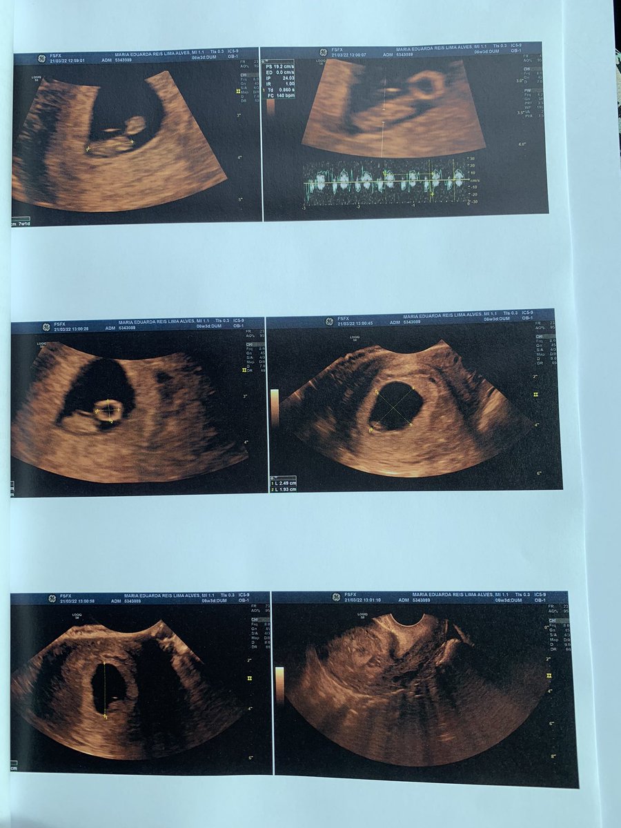 dudareeis_'s tweet photo. Inclusive vou deixar aqui de recordação o primeiro ultrassom, mamãezinha aqui tá morrendo de amor ❤️ https://t.co/s9GcjkYbiu