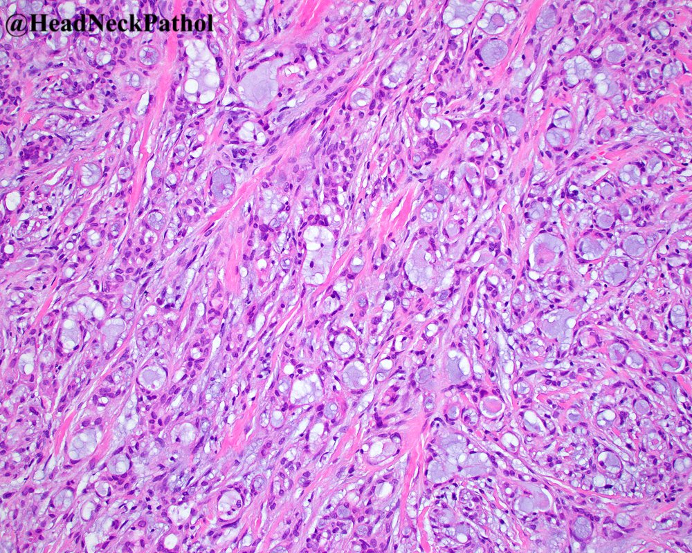 Lester Thompson tweet media