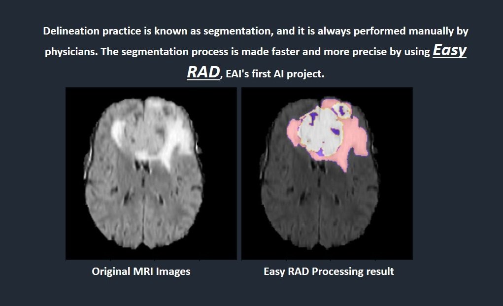 EAIsolutions's tweet photo. #EasyRAD , the #EAI solution's first project, supports #physicians and #radiologists in the fast, secure, and accurate identification of #Cancer diseases .
#AI #ArtificialIntelligence #MachineLearning #healthcare #Medical #radiology 
#EAIToken #EAIsolutions https://t.co/fH3hl8nPdB
