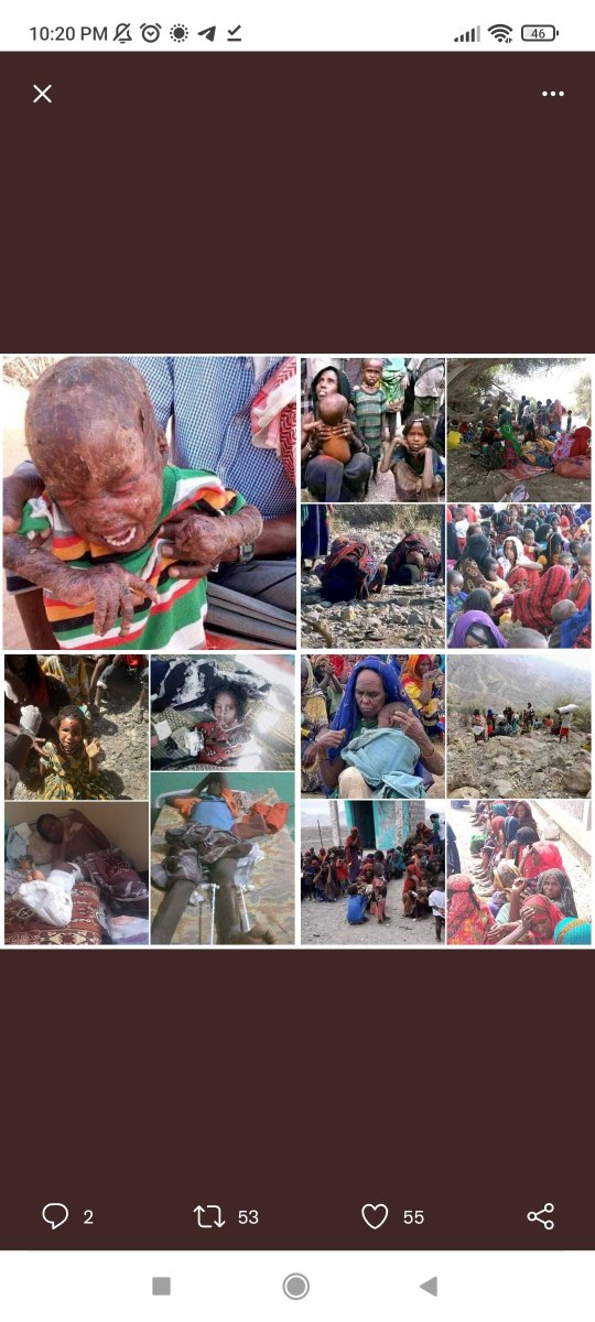 Amanuel69288179's tweet photo. @GHS @DrTedros @WHO The #TPLF lead by the @WHO director-general @DrTedros blocked humanitarian access to Tigray by wagging war in the Afar region 🇪🇹, and shelling civilians indiscriminately. Held #TPLF &amp; @DrTedros accountable for their crimes. #NoMore https://t.co/a7gzyQVQnN