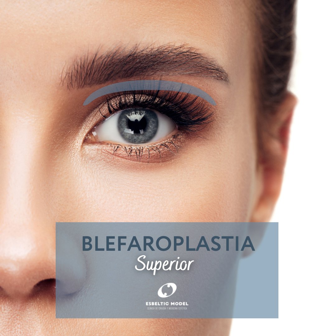 EsbelticModel's tweet photo. Existen diferentes tipos de blefaroplastia, dependiendo de la zona afectada: 

▫ 𝗕𝗹𝗲𝗳𝗮𝗿𝗼𝗽𝗹𝗮𝘀𝘁𝗶𝗮 𝗦𝘂𝗽𝗲𝗿𝗶𝗼𝗿
▫ 𝗕𝗹𝗲𝗳𝗮𝗿𝗼𝗽𝗹𝗮𝘀𝘁𝗶𝗮 𝗜𝗻𝗳𝗲𝗿𝗶𝗼𝗿
▫ 𝗕𝗹𝗲𝗳𝗮𝗿𝗼𝗽𝗹𝗮𝘀𝘁𝗶𝗮 𝗖𝗼𝗺𝗽𝗹𝗲𝘁𝗮

https://t.co/ajo19ZnDwi
#blefaroplastia https://t.co/kfVKtsuQXO