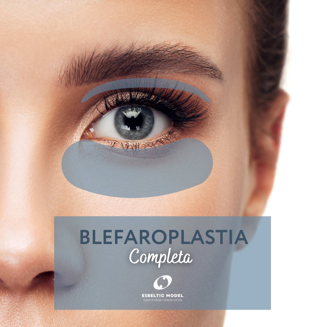 EsbelticModel's tweet photo. Existen diferentes tipos de blefaroplastia, dependiendo de la zona afectada: 

▫ 𝗕𝗹𝗲𝗳𝗮𝗿𝗼𝗽𝗹𝗮𝘀𝘁𝗶𝗮 𝗦𝘂𝗽𝗲𝗿𝗶𝗼𝗿
▫ 𝗕𝗹𝗲𝗳𝗮𝗿𝗼𝗽𝗹𝗮𝘀𝘁𝗶𝗮 𝗜𝗻𝗳𝗲𝗿𝗶𝗼𝗿
▫ 𝗕𝗹𝗲𝗳𝗮𝗿𝗼𝗽𝗹𝗮𝘀𝘁𝗶𝗮 𝗖𝗼𝗺𝗽𝗹𝗲𝘁𝗮

https://t.co/ajo19ZnDwi
#blefaroplastia https://t.co/kfVKtsuQXO