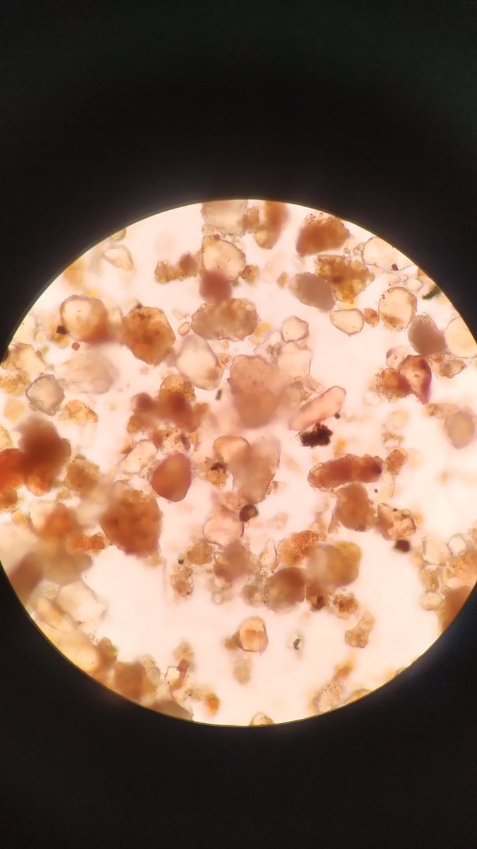 BiocloudUGR's tweet photo. A "little" #SaharanDust in our #pollen samples at Granada city (Spain) (@CanalUGR @GFAT_ugr @iista_es)
📷 1: Monday 15th March
📷 2: Tuesday 16th March https://t.co/HUdWjgvEmq