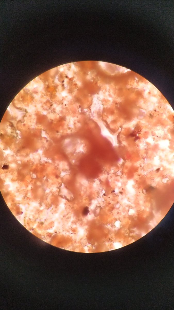 BiocloudUGR's tweet photo. A "little" #SaharanDust in our #pollen samples at Granada city (Spain) (@CanalUGR @GFAT_ugr @iista_es)
📷 1: Monday 15th March
📷 2: Tuesday 16th March https://t.co/HUdWjgvEmq