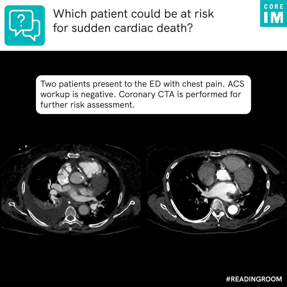 1/ It’s time for #ReadingRoom with CoreIM!
 
Looking at these CT scans, which patient could be at risk for sudden cardiac death?