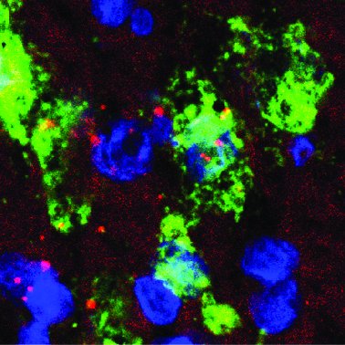NCCR-Synapsy (@nsynapsy) on Twitter photo Individuals can respond to #stress in diametrically opposed ways. A <a href="/NSynapsy/">NCCR-Synapsy</a> study by <a href="/carmensandi10/">Carmen Sandi</a> shows that the behavioral response depends on the level of #anxiety and identifies the cerebral mechanisms involved.
nccr-synapsy.ch/news/14219/
<a href="/EPFL_en/">EPFL</a> Individuals can respond to #stress in diametrically opposed ways. A <a href="/NSynapsy/">NCCR-Synapsy</a> study by <a href="/carmensandi10/">Carmen Sandi</a> shows that the behavioral response depends on the level of #anxiety and identifies the cerebral mechanisms involved.
nccr-synapsy.ch/news/14219/
<a href="/EPFL_en/">EPFL</a>