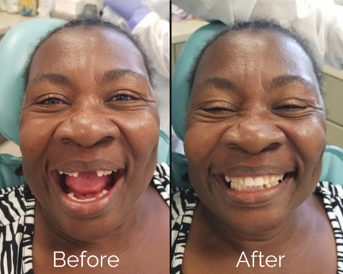 GreatShapeInc's tweet photo. BIG UP from Papa Joe! $39K Raised for One One Coco! ~ See your coco in action in Turks &amp; Caicos...patients received dentures just last week thanks to you!
https://t.co/sfXrwgGxLl https://t.co/HbSIkPgiaF