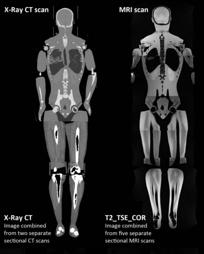 PureImaging's tweet photo. Introducing the new Full Adult Body Phantom! Compatible with all main modalities it contains all major bone structures and organs. We can fully customise to your requirements. REQUEST QUOTE NOW! 

#xray #nhs #anthropomorphic #medicalimaging #humanbody #medicalphysicist #rsna #ecr https://t.co/nHWhJddryj