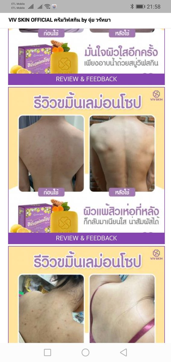 DSomdeth's tweet photo. ຫາຍ....​ກຣິບເລີຍສິວ https://t.co/uD49C72Ekg