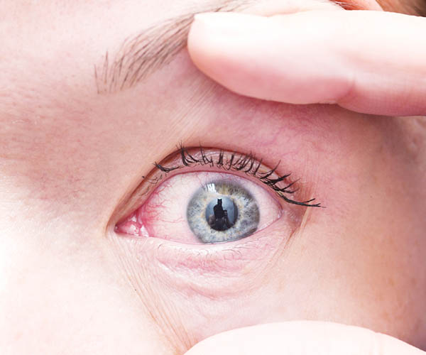 SilversteinEye's tweet photo. Is it time for your next eye exam?

You can read through our blog to find out how often you should have regular exams:
 https://t.co/A82KkCtJBv 

Schedule your appointment: KC: (816) 358-3600 | Odessa: (816) 230-5321

#EyeExams #Vision #KansasCity #DrSilverstein https://t.co/rscRTTNtDn
