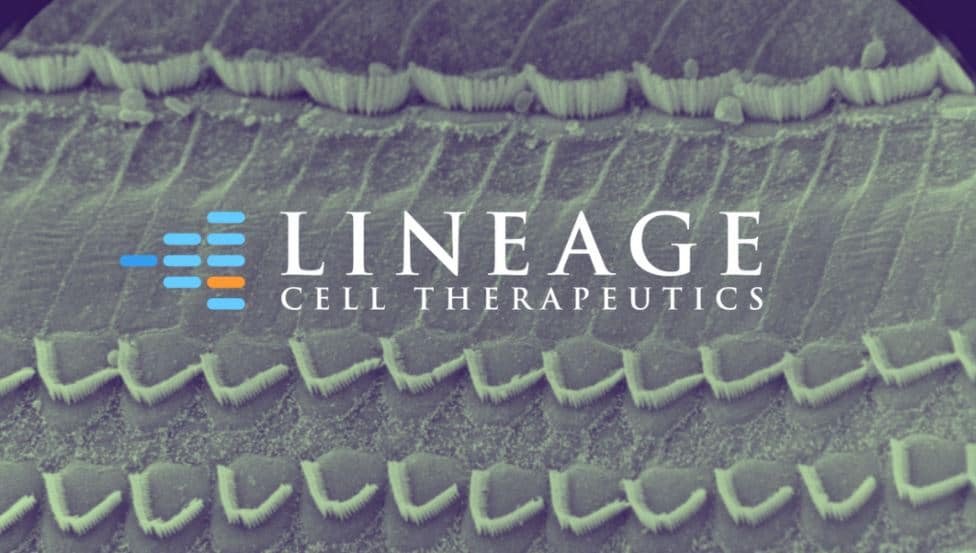 MedTechNow_'s tweet photo. Clinical Launches

@Eko_Health launches screening app for early #HeartDisease detection

@TwistBioscience launches #SyntheticRNA positive controls for #COVID in #Imagene’s capsules

@LineageCell expands #celltherapy pipeline to include #neuronal cell #transplant for #hearingloss https://t.co/n9gxgMcH0F