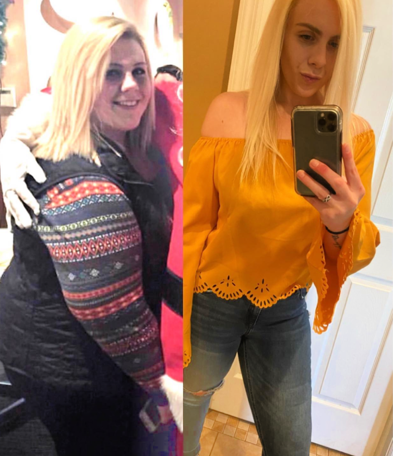 DrAdeyeri_NJ's tweet photo. Kaylee chose #gastricbypass to lose 120 pounds when she was just 20-years-old. I was delighted to get this 5-year update: https://t.co/BUNGNnlECZ #hackensackmeridianhealth #oldbridge https://t.co/GVmEzwD9sS