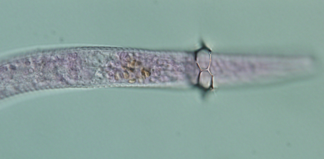 NemaMarta's tweet image. Question!! I found this structure around a Diplopeltoides´cuticle. It forms sort of a ring divided in cells with spines. It´s the first time that I see it. Does anybody know what could it be? #Nematoda