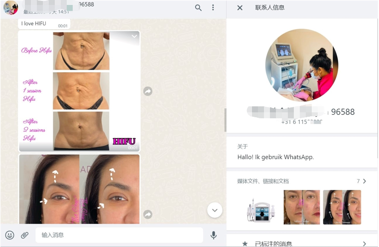 EVALASERTECH's tweet image. ≥ 98% customer satisfaction
100% ROI

Win clients and wealth, what are you waiting for?

❤️ ONLY 1150USD, you can have it. ❤️

#hifu #hifufacial #7dhifu #bodybuilding #bodyshape #neckwrinkles #doublechin #doublechinremoval #eyebrows #skinlifting #skintightening #skincare #HIFU