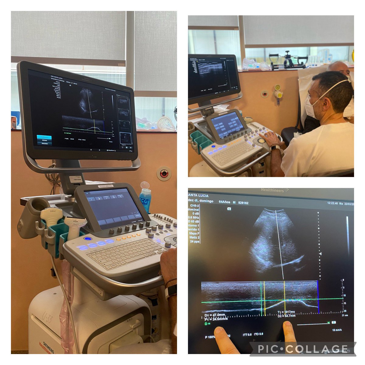 NeumoCT's tweet photo. Incorporamos nuevas herramientas en consulta #ELA Eco diafragmática nos ayuda a mejorar la calidad de la atención a nuestros pacientes con patología respiratoria #neuromuscular 🧠🫁 #VMD #elaregiondemurcia @SeparRespira @FISIOSEPAR @EnfermeriaSepar @Neurologiactg @Area2Cartagena https://t.co/z6HOUug3YL