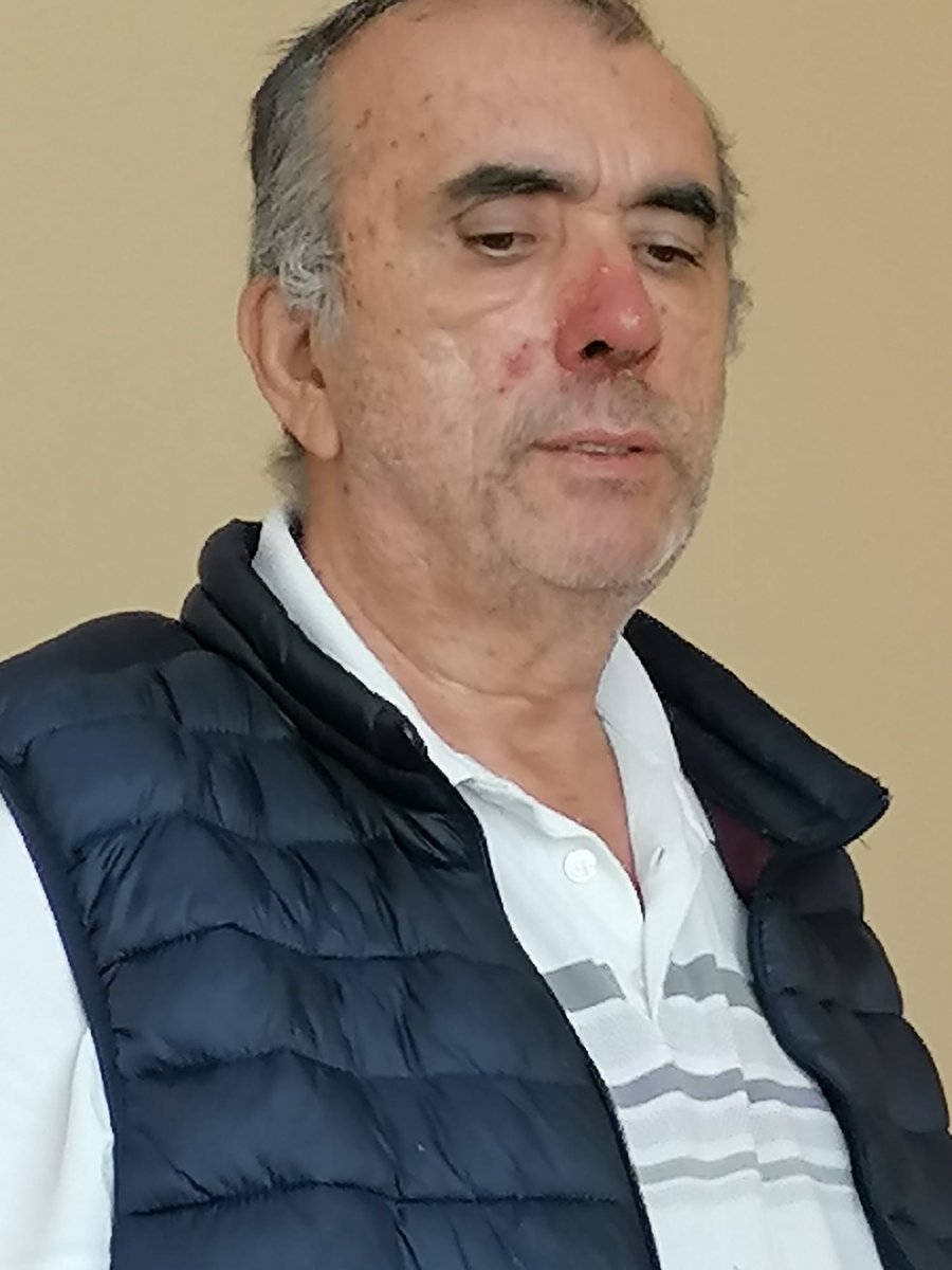 sevincozarslan's tweet photo. 4. evre akciğer kanseri Ahmet Zeki Özkan 42 gündür Antalya L Tipi'nde tutuklu. 

Grip değil bu adam, kanser, 4. evrede. Ölümle burun buruna. 

"İnsan yaşat ki devlet yaşasın" sözünü kimse ağzına almasın. Ölüyor adam. @adalet_bakanlik  

TutukluHasta Kalmasın https://t.co/qFBDUrkOpe