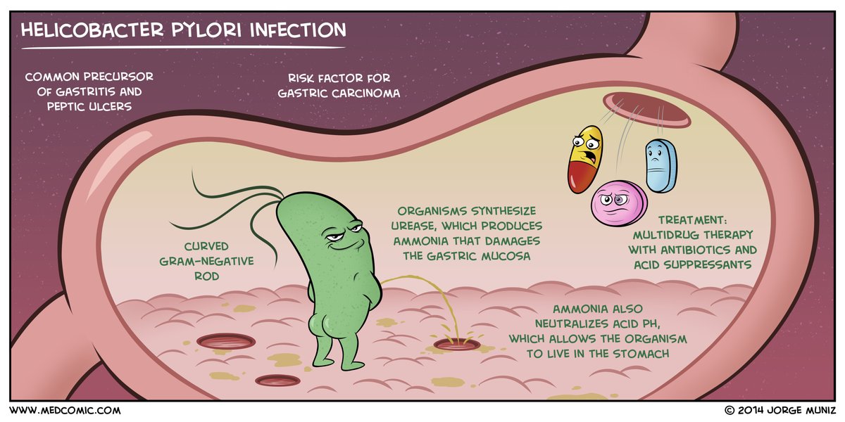 MedComic's tweet photo. H. Pylori Infection #Meded
https://t.co/hjdc7B2546 https://t.co/creVgTCw4i