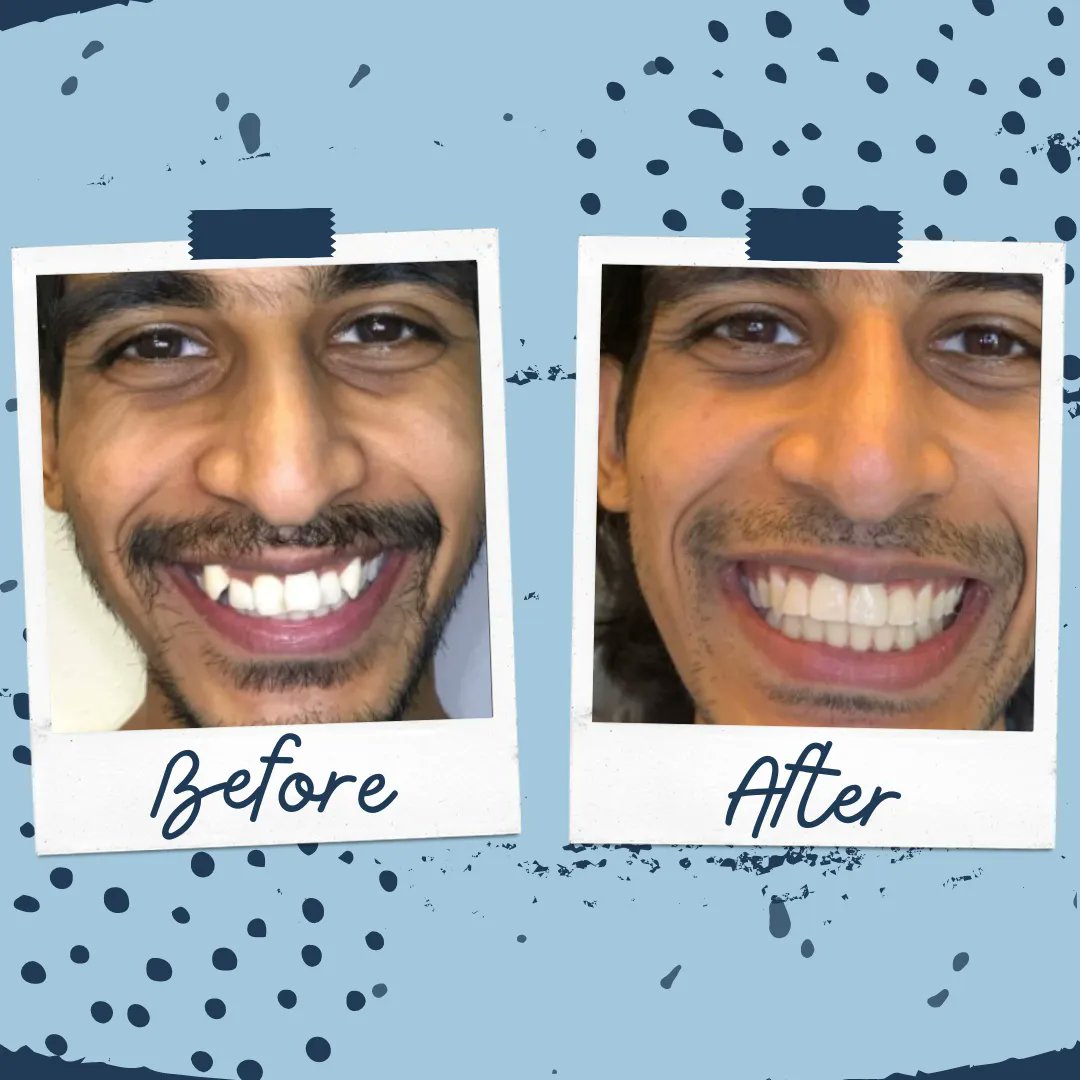 The results are in! and @CoutureDentistry has shared an amazing #SmileTransformation on #TransformationTuesday
