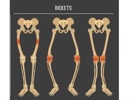 rocque55's tweet image. #NoToRicketts