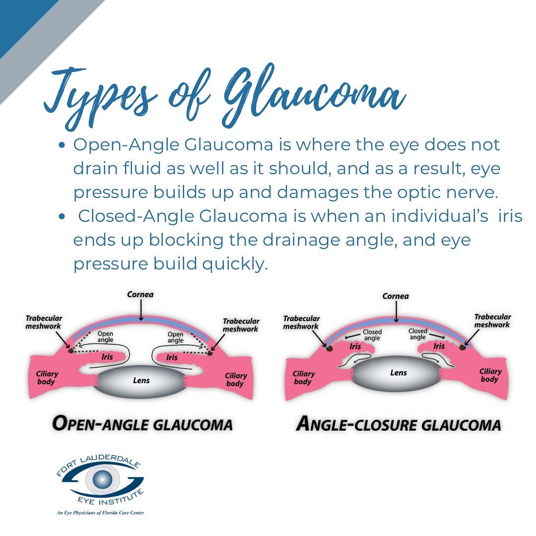 fleieye's tweet photo. Glaucoma is one of the leading causes of blindness, and can be gradual in its development. The disease can be painless and fail to demonstrate any noticeable symptoms. Routine eye exams help screen and detect #glaucoma so it is essential to schedule an exam periodically. https://t.co/RngKfkCD3C