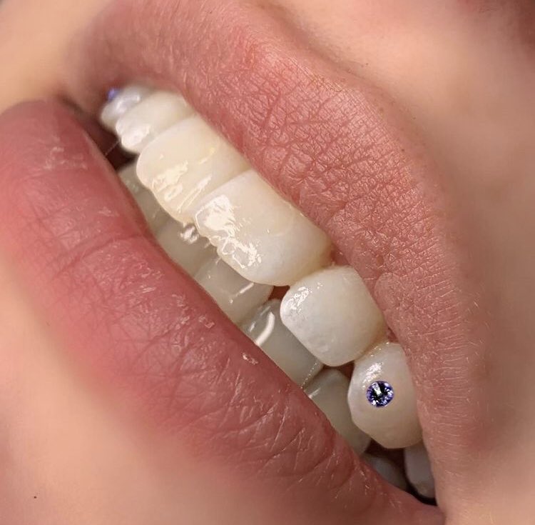 drflossa's tweet photo. New Tooth Gem! 

This will def replace gold teeth. https://t.co/10TH2WIXmh