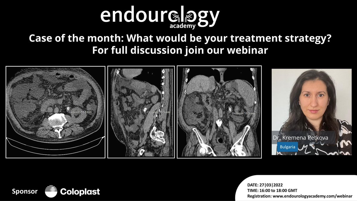 Join us on Sunday at the Endourology Academy Webinar for some tips snd tricks in URS and case discussions endourologyacademy.com/webinar <a href="/drkemalsarica/">Kemal Sarıca</a> <a href="/EndoLuminalEndo/">Daron Smith</a> <a href="/endouroacademy/">Endourology Academy</a> <a href="/PabloNContreras/">Pablo Contreras</a>