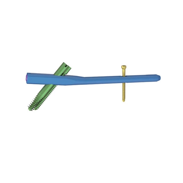 ZSORTHOSOLUTION's tweet photo. PNFA 2 interlocking nail on sale - https://t.co/jNQ4FfiLTh https://t.co/kBzDxJBMWt