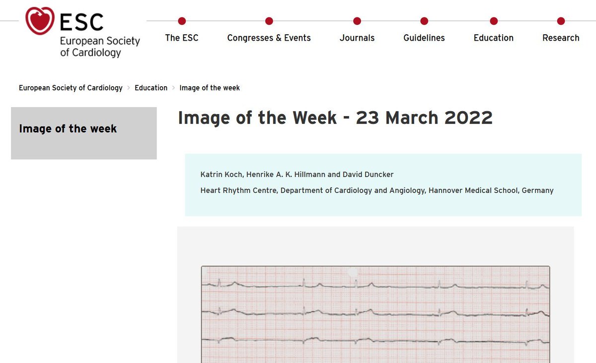 Look at our contribution to ESC - Image of the Week, nice way to start the day with a quiz
<a href="/HenrikeHillmann/">Henrike Hillmann</a> 

escardio.org/Education/Imag…