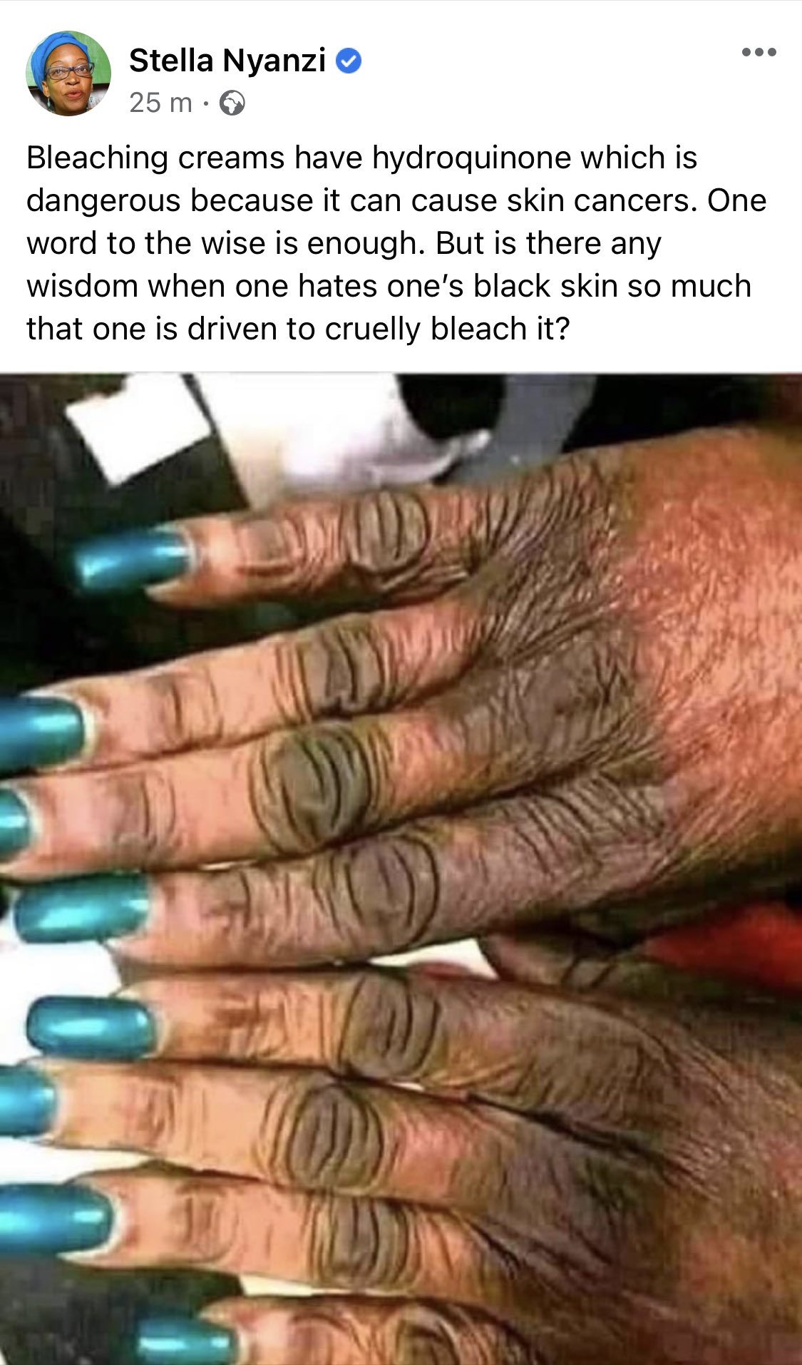 Yall just love it when you peel the skin off your nail : r/memes