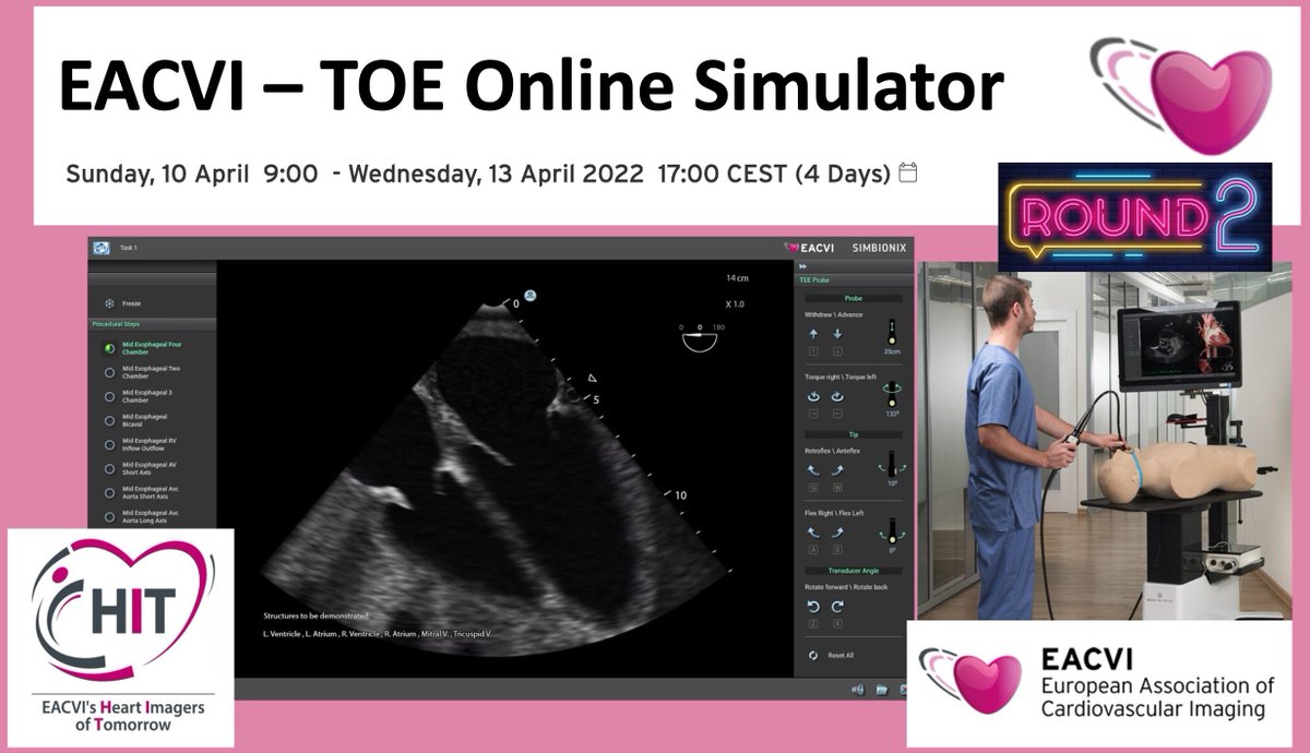 🚀EACVI - TOE Online Simulator Register for the first online EACVI training using a Virtual Simulator to evaluate your TOE skills and knowledge. Our HIT project 100% online! EACVI certificate at the end of your session🏅 📲EACVI Registration link:lnkd.in/dwn8rWqX