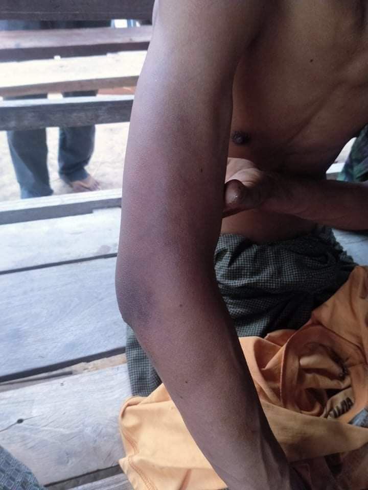 katycho22222's tweet photo. Ko Mg Nyunt&Ko Phyo Hein were beheaded and burnt down by PyuSawHtee group and 2 other detainees were also brutally tortured.They also killed 2 residents in #ChaungOo tsp. #2022Mar23Coup #LightBehindBars #ICRC_HelpYouthActivists #WhatsHappeningInMyanmar https://t.co/ascW3by6Oh