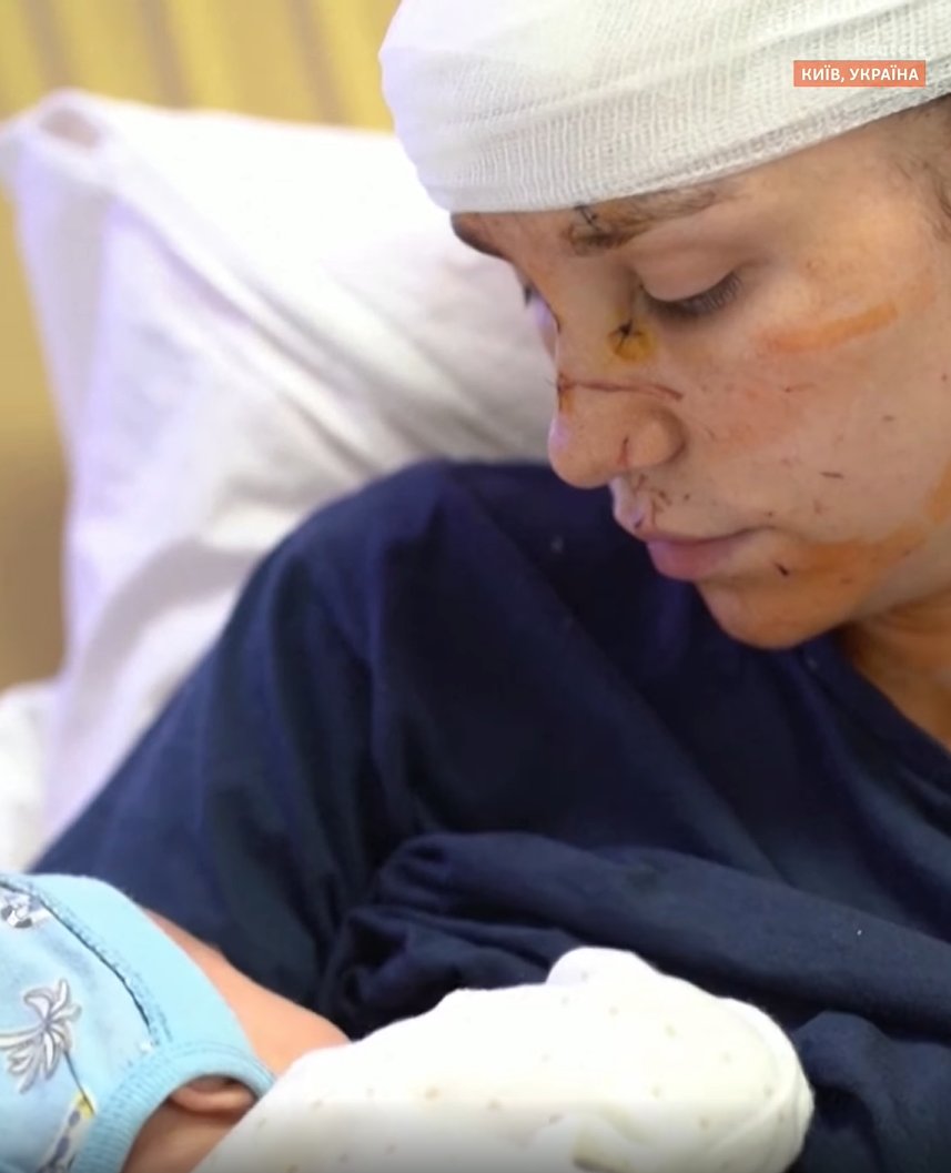 OlenaHalushka's tweet photo. Olga shielded her newborn girl when the blast broke the windows in their home. The shards of glass wounded Olga's head and breasts, causing around 25 injuries. The baby is fine https://t.co/VetufO3aXQ