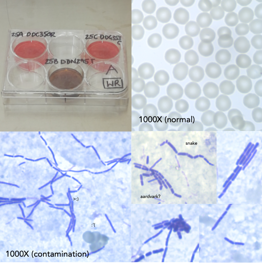 emmafernn's tweet photo. Happy #ContaminationClub @ContamClub Nobody's perfect! One of the cooler contaminations of #malaria #plasmodium culture I've seen. Ah well, this transfection was unlikely to work anyway... 🧫🔬 https://t.co/JbSox2Y5Rm