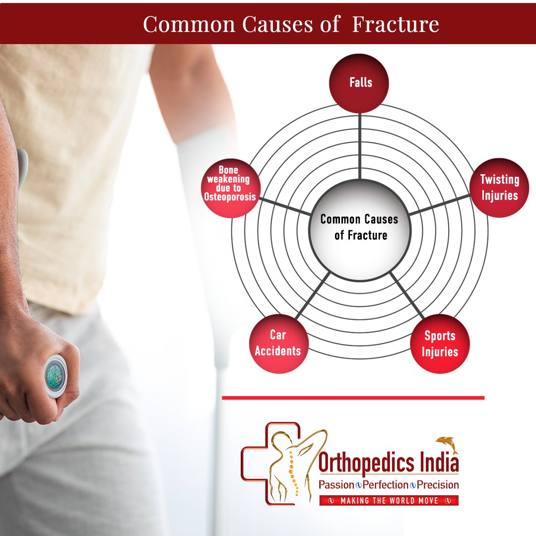 OrthopaedicsI's tweet photo. Bone fractures are caused by one of these things:
 Falls, twisting injuries, sports injuries, car accidents, and even fights are all examples of trauma.

For any type of fracture, Please call 7358 000 123 or visit www. https://t.co/bspcltyzJ6.

#fracture #Orthopedics #Bones #BONE https://t.co/eqbLW22VIM